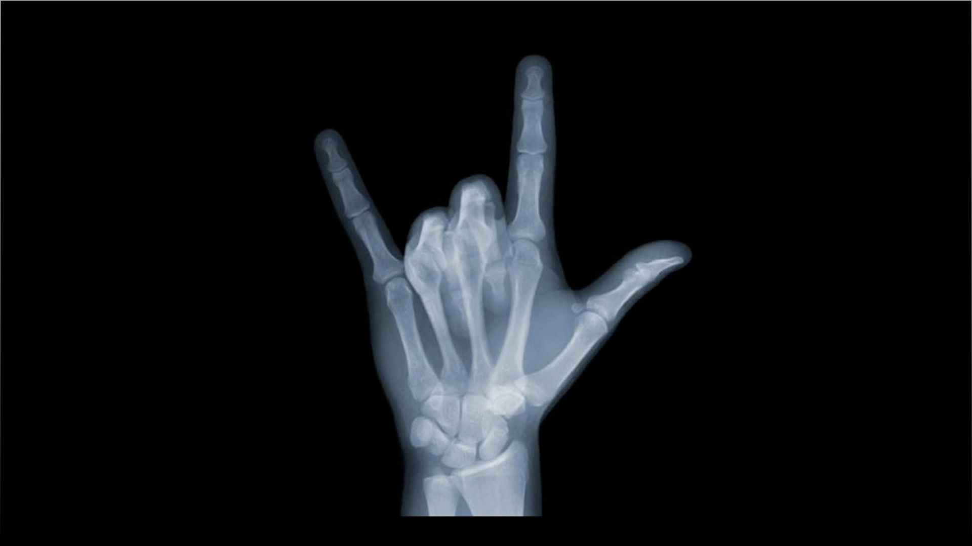 О роли рентгена в музыке и медицине